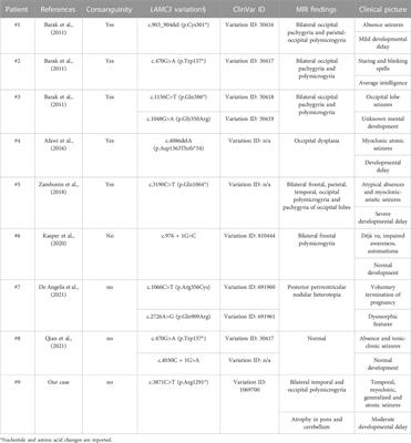 Case report: LAMC3-associated cortical malformations: Case report of a novel stop-gain variant and literature review